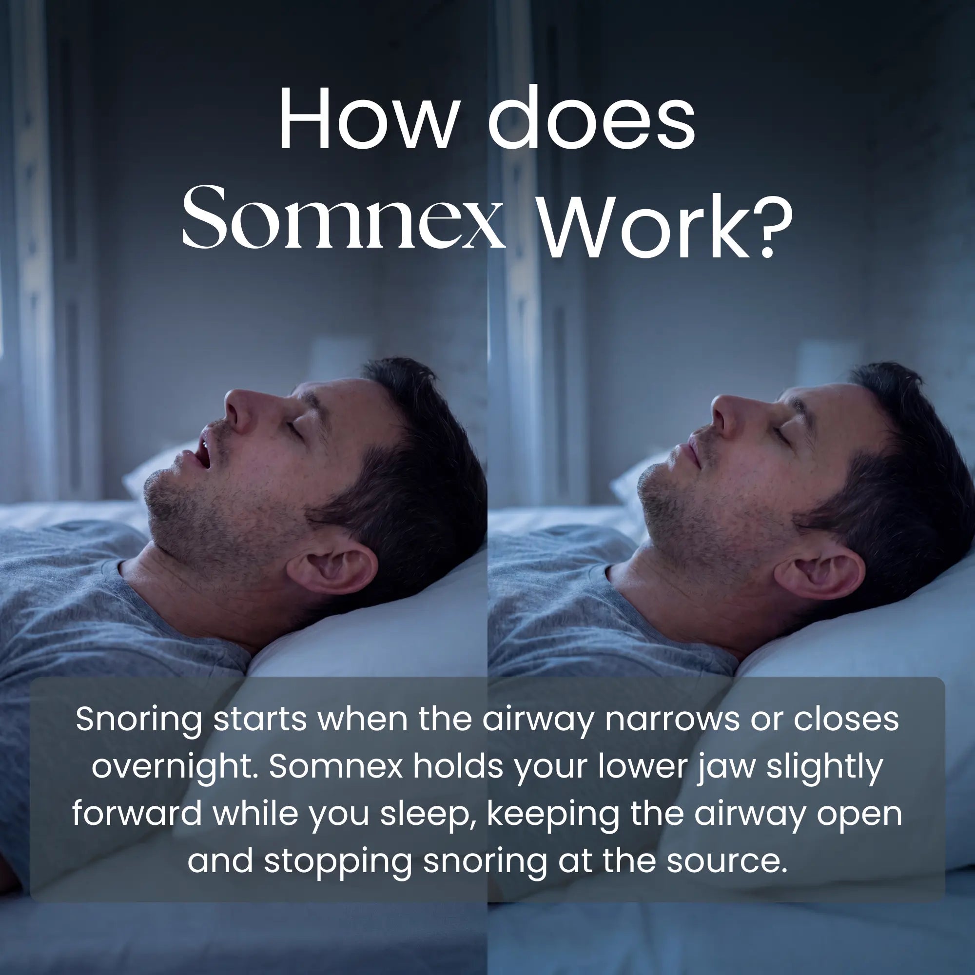 Somnex Pro™ Anti-Snoring Mouthpiece